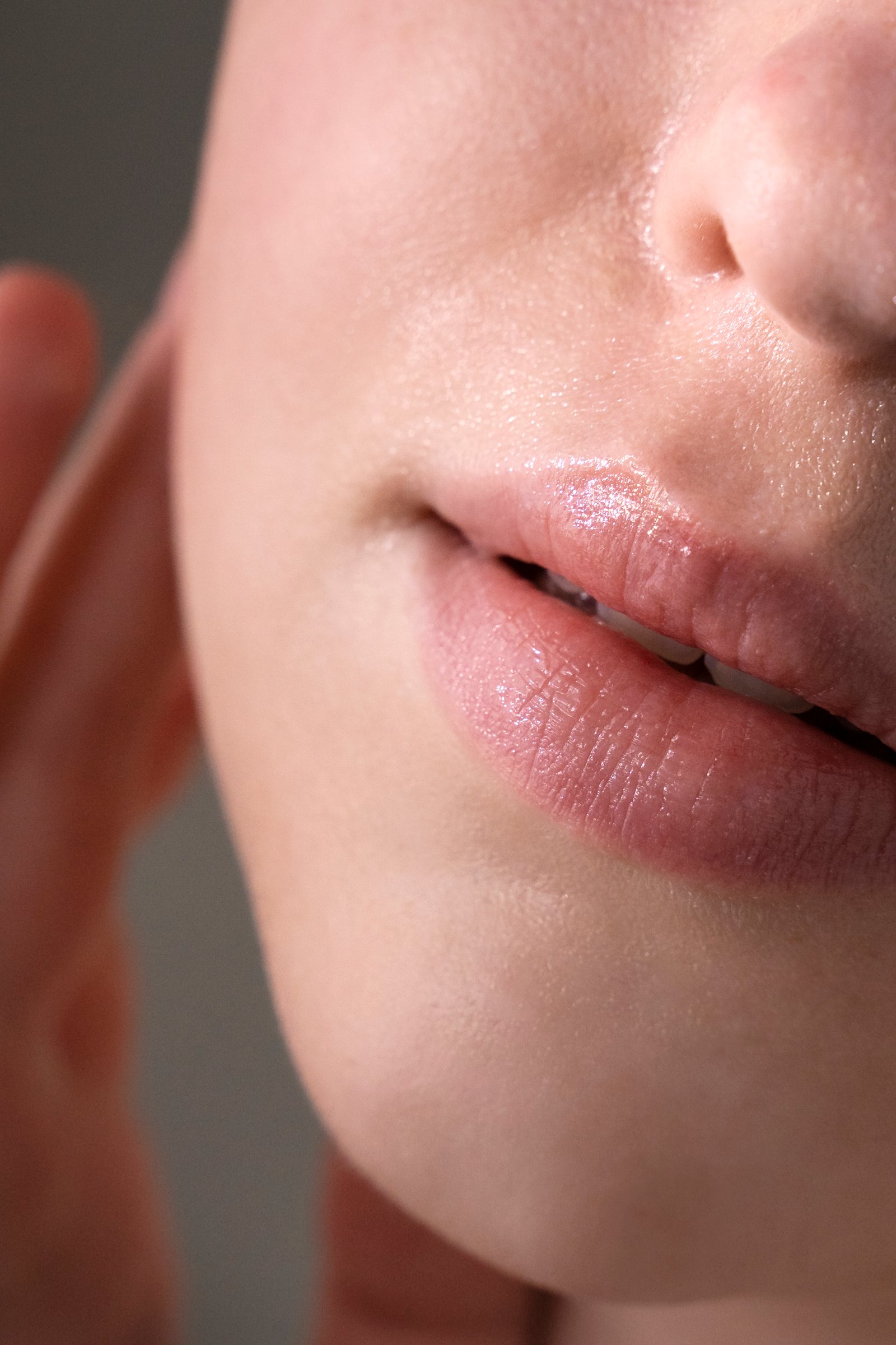 Specialist performing laser lip pigmentation treatment at Hues Aesthetic Clinic Madurai